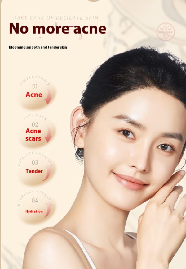 Herbal Acne Cream with Plant Extracts – Soothing & Anti-Inflammatory Formula - Image 2