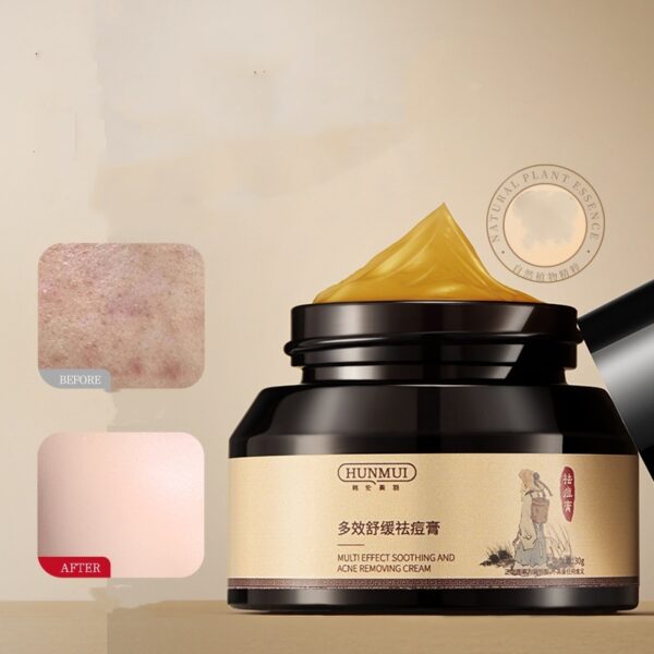 Herbal Acne Cream with Plant Extracts – Soothing & Anti-Inflammatory Formula - Image 4